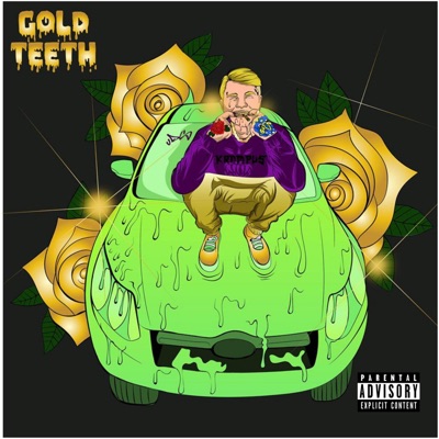 Gold Teeth